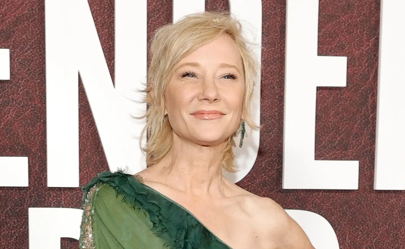Anne Heche dies at 53 after not surviving a car accident