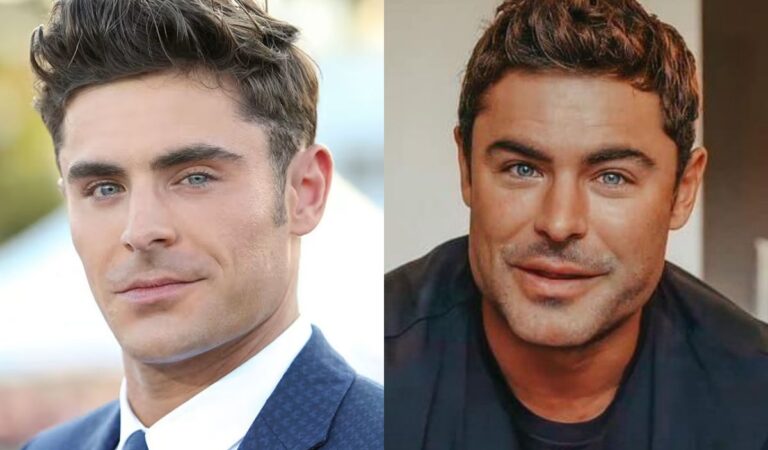 Zac Efron tells the truth behind the radical change in his face